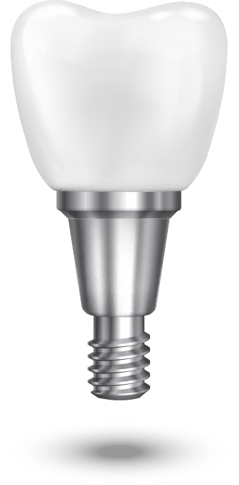 what is a dental implant bristol