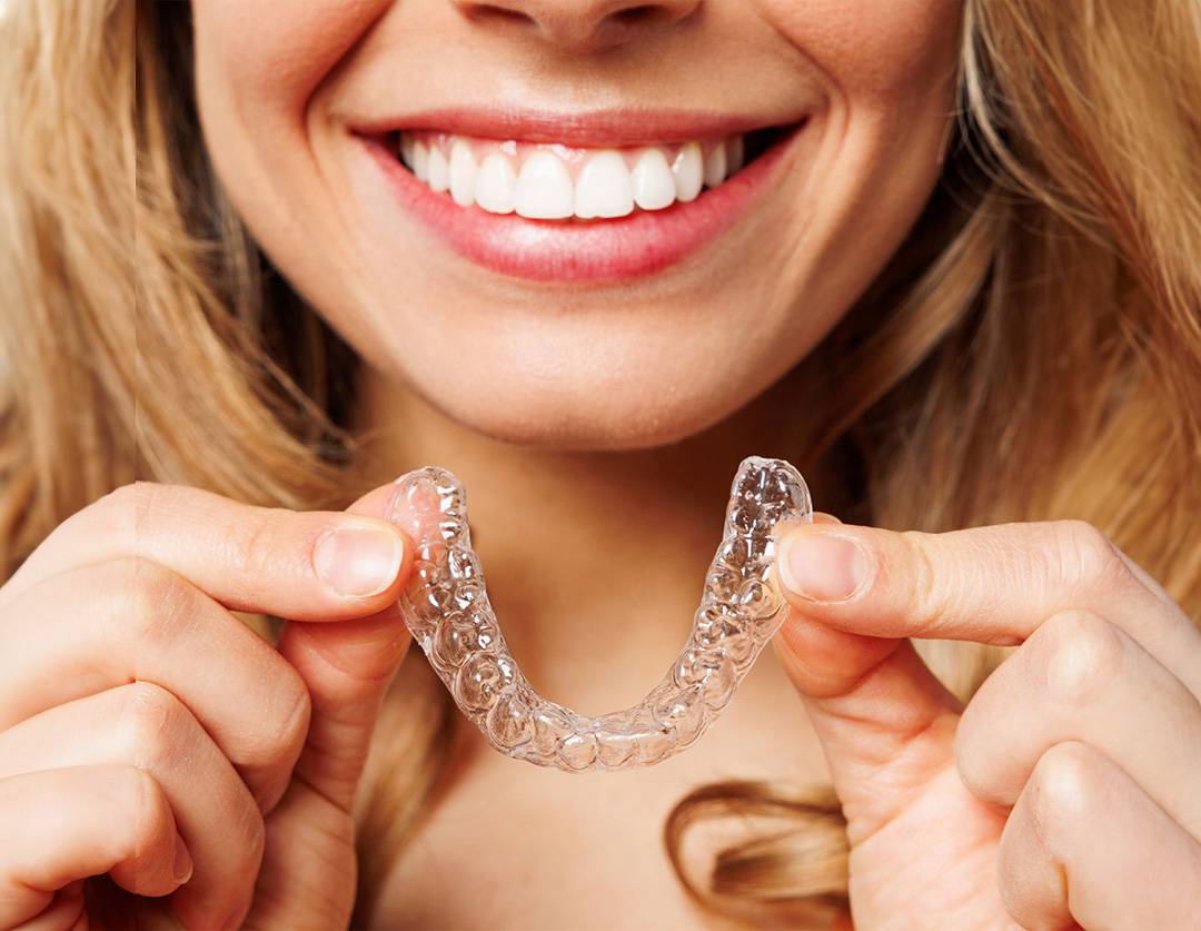 Invisalign Braces Bristol